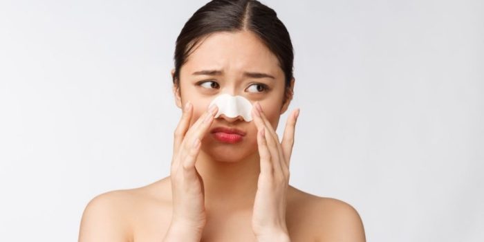 18666-ilustrasi-masalah-komedo