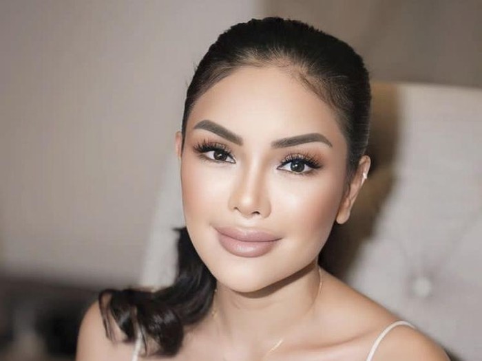 wajah-nikita-mirzani-usai-oplas-4_43