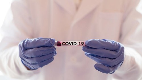 dua-anggota-polri-positif-covid-19-di-batam-220806v-rev1.jpg